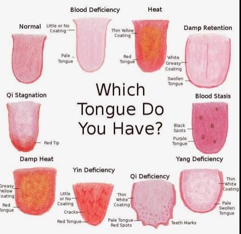 Using the Tongue as a Diagnostic Tool.